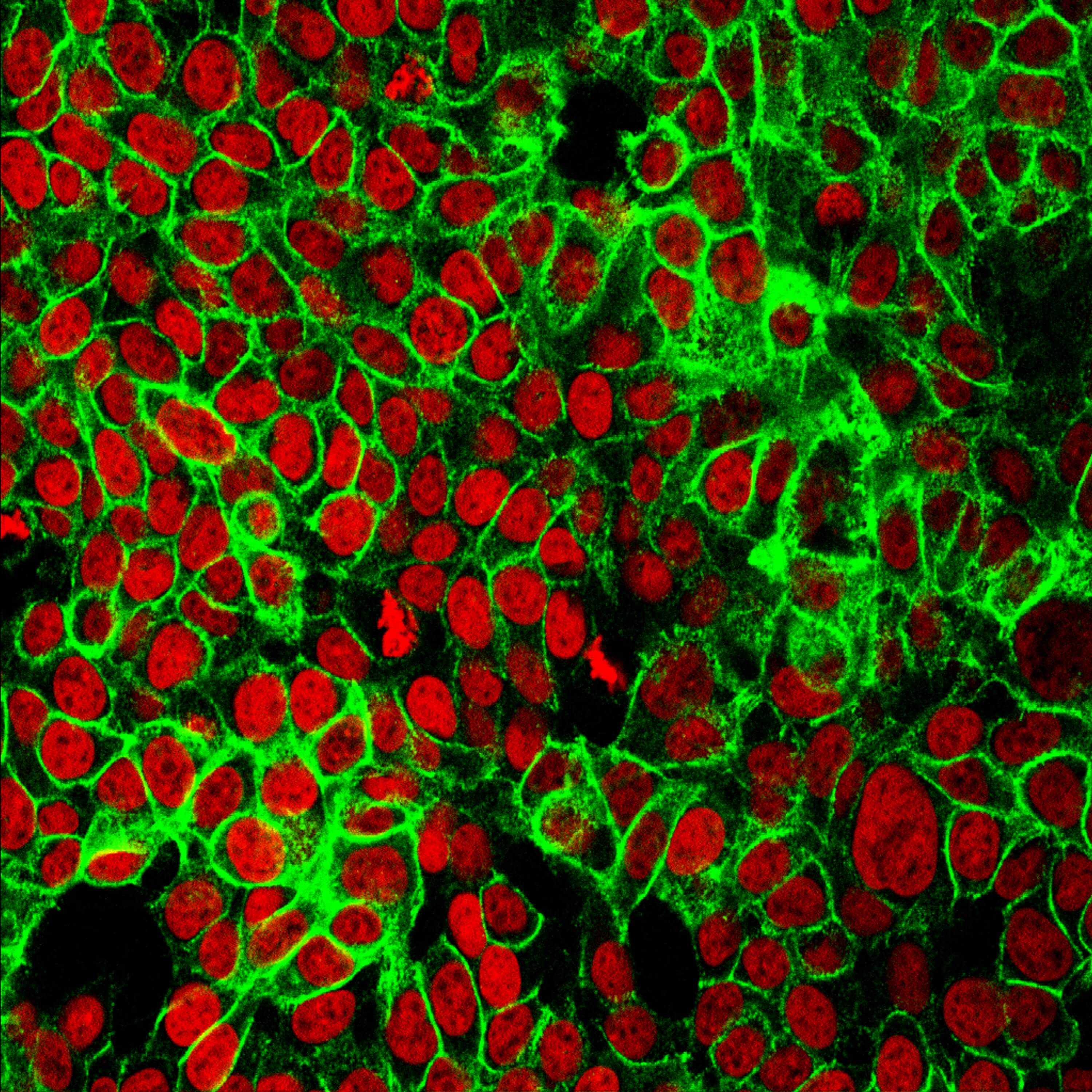 Mikroskopisches Bild von Zellen mit rot gefärbten Kernen und grün gefärbten filamentösen Strukturen, die möglicherweise Komponenten des Zytoskeletts darstellen.